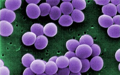 Does antibiotic resistance matter in a viral pandemic?